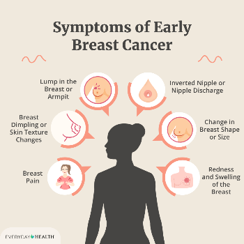 Breast Cancer - Effective Treatment options
